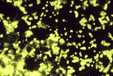 A CRISPR-Cas system enhances envelope integrity mediating antibiotic resistance and inflammasome evasion | Genetic Engineering Publications - GEG Tech top picks | Scoop.it