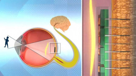 Bio-Retina: Un implante para devolverles la vista a los ciegos | Salud Visual 2.0 | Scoop.it