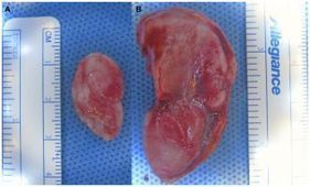 Bioingenieria e impresoras 3d: Artificial human ear bioengineered with help of 3D printer (VIDEO) | Diversifíjate | Scoop.it