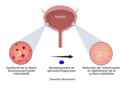 Des nanoplaquettes compos&eacute;es de glycosaminglycanes pour traiter l&rsquo;inflammation des muqueuses | Life Sciences Universit&eacute; Paris-Saclay | Scoop.it