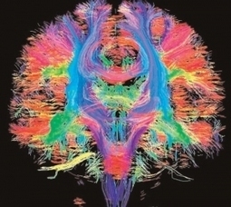 The Brain in Technicolour | Science News | Scoop.it