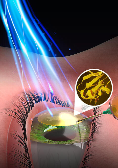 Healing power of light: Research team advances clear vision for eye repair | Biomimicry 3.8 | Scoop.it