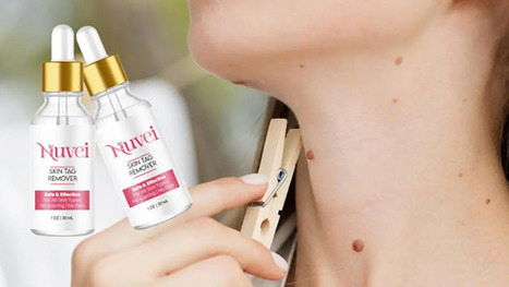 Nuvei Skin Tag Remover [#Exposed] Reviews 2023 Scam or So Smooth Skin Tag Mole Removal That Works? | Nuvei Skin Tag Remover Benefits | Scoop.it