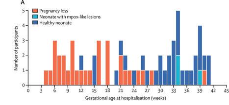 Mpox : un risque tr&egrave;s &eacute;lev&eacute; de perte f&oelig;tale en cas d&rsquo;infection pendant la grossesse | actualit&eacute;s VIH, h&eacute;patites, IST, sant&eacute; sexuelle | Scoop.it