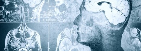 e-Santé : ElMindA révolutionne le diagnostic des pathologies du cerveau | UseNum - Santé | Scoop.it