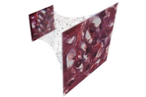 UCLA engineers use deep learning to reconstruct holograms and improve optical microscopy | Amazing Science | Scoop.it