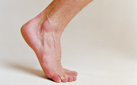 Ask Well: Healing Plantar Fasciitis | Physical and Mental Health - Exercise, Fitness and Activity | Scoop.it