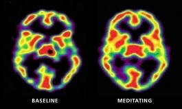 Shambhala Sun - This is Your Brain on Mindfulness (July 2011) | attention | Scoop.it