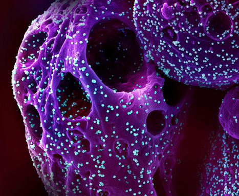 NIH RECOVER Research Identifies Potential Long COVID Disparities | Virus World | Scoop.it