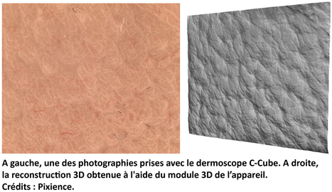 CNRS Innovation - Brevets et licences - La stéréophotométrie pour mettre le relief de la peau en lumière | L'IRIT UMR5505 (CNRS-Toulouse INP-UT-UT Capitole-UT2) dans les médias en ligne | Scoop.it