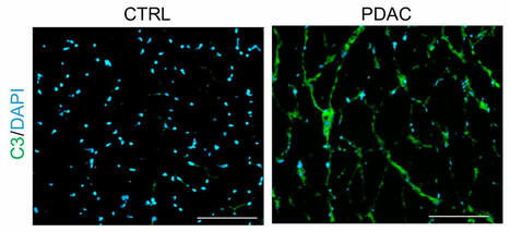 Muscle samples from... - Journal of Clinical Investigation | Immunology | Scoop.it