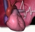 Stress-induced blood pressure boost tied to stroke - TeleManagement | Stress Management | Scoop.it
