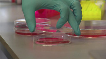 Malaria: Scientists Identify Proteins, Breakthrough In The Fight Against Malaria | World News | Sky News | Aplicaciones m&oacute;viles: Android, IOS y otros.... | Scoop.it