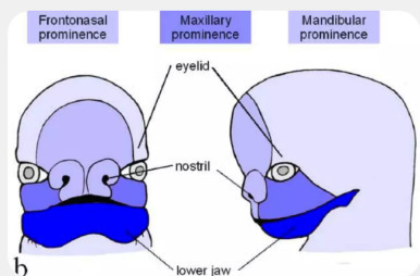 Goldenhar Syndrome: Gene responsible for severe facial defects identified | Amazing Science | Scoop.it