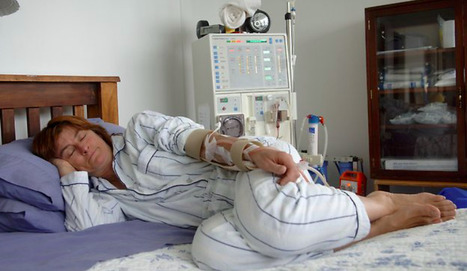 Difference of fatigue in patients on peritoneal dialysis versus hemodialysis and the association with nutrition and inflammation | Peritoneal dialysis | Scoop.it