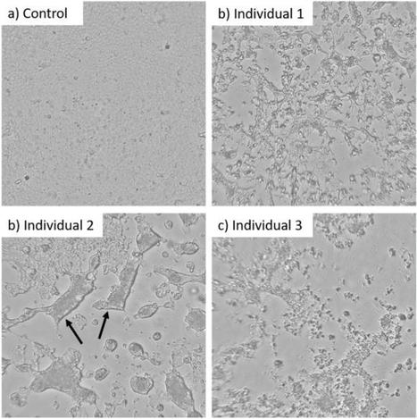 Infectivity of exhaled SARS-CoV-2 aerosols is sufficient to transmit covid-19 within minutes | Scientific Reports | Mucosal Immunity | Scoop.it