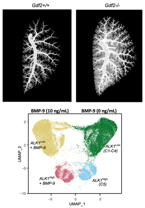 Un facteur clé pour l’équilibre vasculaire pulmonaire : le rôle essentiel de BMP-9 mis en lumière | Life Sciences Université Paris-Saclay | Scoop.it