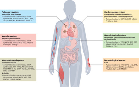 An update on autoantibodies in the idiopathic inflammatory myopathies | Nature Reviews Rheumatology | AUTOIMMUNITY | Scoop.it
