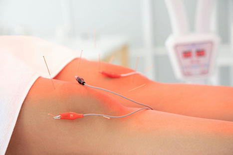The Benefits of Acupuncture and Electroacupuncture | Call: 915-850-0900 | Chiropractic + Wellness | Scoop.it