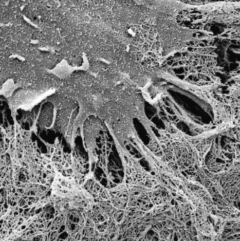 Kurzweil : "Self-assembling material could lead to artificial arteries | Ce monde à inventer ! | Scoop.it