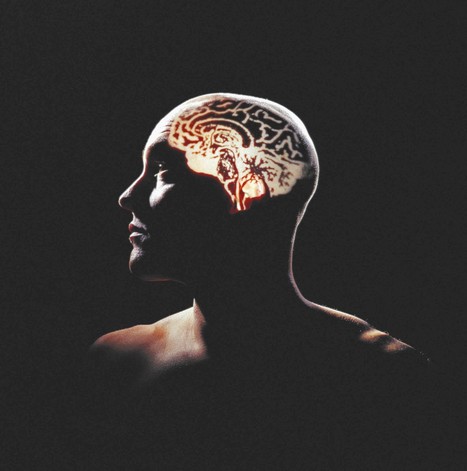 Researchers suspect brain's slow waste disposal in Alzheimer's - Chicago Tribune | NeuroImmunology | Scoop.it