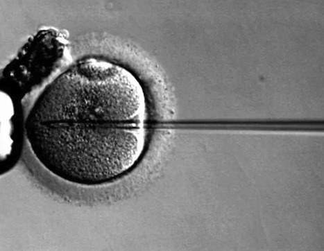 Gene Therapy Brings Back Hearing in Young and Adult Deaf Patients | Virus World | Scoop.it