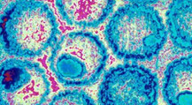 Viruses may soon be used to treat cancer: Scientists | Virology News | Scoop.it