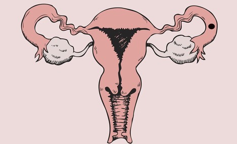 Grossesse extra utérine : symptomes, causes, traitements | Famille et sexualité | Scoop.it