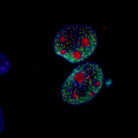 L’hormonothérapie a un impact plus important que la chimiothérapie sur la qualité de vie des femmes | Life Sciences Université Paris-Saclay | Scoop.it