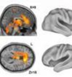 Scientists solving the mystery of human consciousness | e! Science News | Kinsanity | Scoop.it