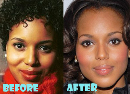 kerry washington plastic surgery before and aft kerry washington plastic surgery before