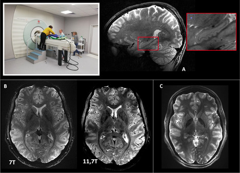 FOCUS PLATEFORME : NeuroSpin : Première mondiale chez l’homme à un tel champ magnétique : l’IRM Iseult (11.7T) livre ses premières images in vivo de cerveau humain ! | Life Sciences Université Paris-Saclay | Scoop.it