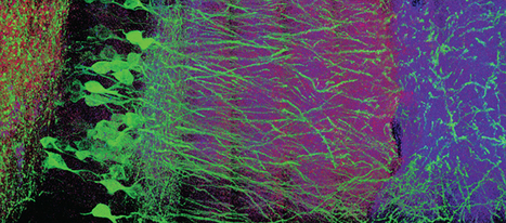 Practical Course -- Expansion Microscopy -- Gustave Roussy -- 18-19 Novembre 2019 | Life Sciences Université Paris-Saclay | Scoop.it
