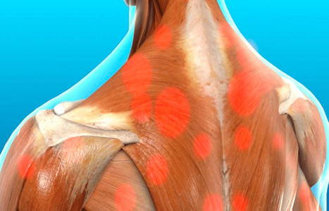 Myofascial Trigger Pain Affecting The Trapezius Muscle | Call: 915-850-0900 | Mobility & Flexibility - Joint Movement | Scoop.it