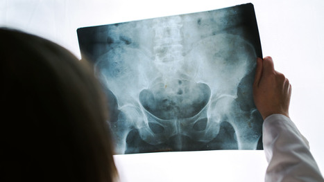 Acute Pelvis & Hip Trauma Imaging Diagnosis Part I | El Paso, TX Chiropractor | Call: 915-850-0900 | Mobility & Flexibility - Joint Movement | Scoop.it