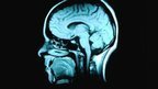 Man and robot linked remotely by brain scanner | Amazing Science | Scoop.it