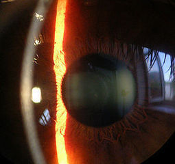 Un tratamiento basado en células madre permitirá paliar patologías de origen corneal | Salud Visual 2.0 | Scoop.it