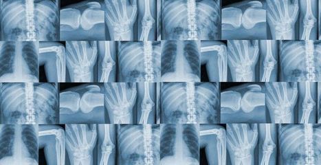 Swansea Radiology teaching site - Radiology for medical students | Radiology | Scoop.it