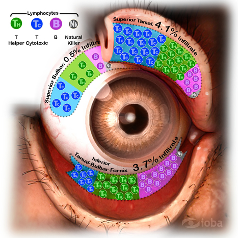 Topographical distribution and characterization of epithelial cells and intraepithelial lymphocytes in the human ocular mucosa. [Mucosal Immunol. 2012] - PubMed - NCBI | Immunopathology & Immunotherapy | Scoop.it