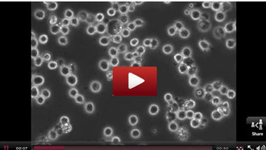 Virus-derived particles target blood cancer | KurzweilAI | Longevity science | Scoop.it