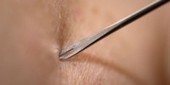 Skin-Deep Immunity | The Scientist | Virology News | Scoop.it
