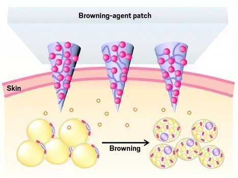 Microneedle skin patch fights fat | Intra-Dermal drug delivery: Opportunities and Challenges? | Scoop.it