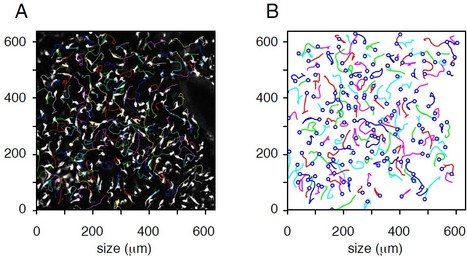 La simulation math&eacute;matique du d&eacute;placement des m&eacute;lanoblastes r&eacute;v&egrave;le de nouveaux m&eacute;canismes cellulaires et mol&eacute;culaires lors de la mise en place du lignage m&eacute;lanocytaire | Life Sciences Universit&eacute; Paris-Saclay | Scoop.it