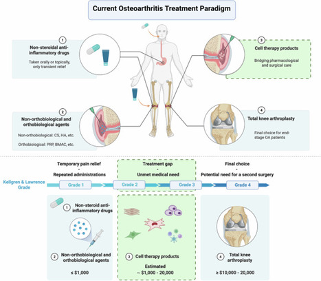 Next-generation therapies for osteoarthritis: the evolving role of cell therapy products | Experimental & Molecular Medicine | Rheumatology-Rhumatologie | Scoop.it