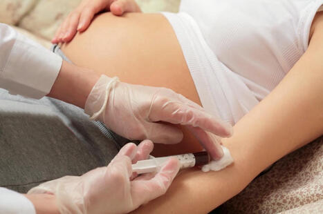 Cytomégalovirus (CMV) chez la femme enceinte : la HAS recommande un dépistage systématique pour toutes à réévaluer après 3 ans de mise en œuvre | Revue de presse Implant Cochléaire | Scoop.it