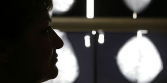 Comment retravailler apr&egrave;s un cancer? | L'Express, 3/5/2012 | CREADOC Nice | Scoop.it