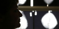 Comment retravailler après un cancer? | L'Express, 3/5/2012 | CREADOC Nice | Scoop.it