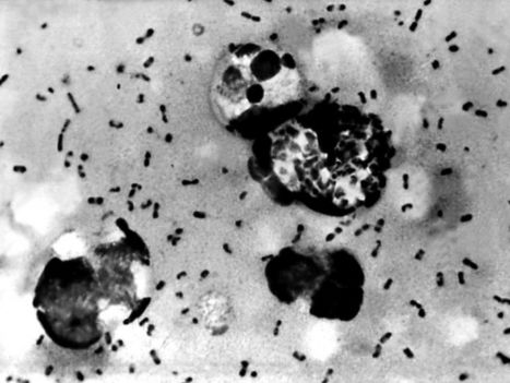 Plusieurs cas de peste bubonique ont été recensés en Chine | EntomoNews | Scoop.it