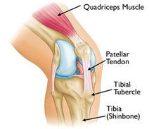 Osgood-Schlatter Disease (Knee Pain) | Sports Injuries | Scoop.it