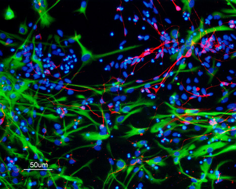 Featured Photo: hiPSC-Derived Astrocytes and Neurons | iBB | Scoop.it